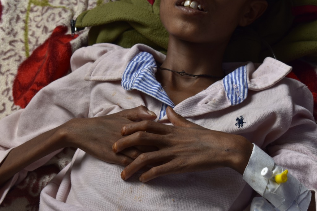 Tigré tartományban nagy az éhezés